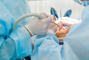 Dental implant surgery