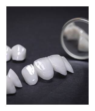 Metal free dental crown and other restorations prior to placement