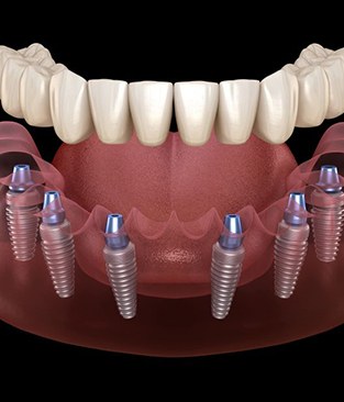 patient visiting dentist for checkup