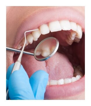 Dental patient performing oral cancer screening