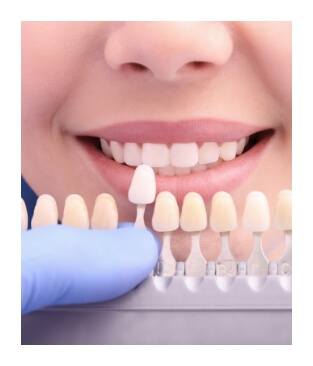 Closeup of smile compared with tooth colored filling shade chart