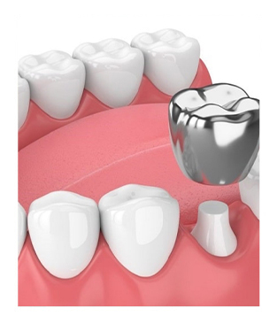 Animated smile during stainless steel dental crown placement
