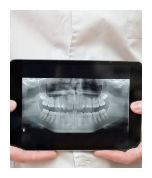 All digital x-rays on tablet computer screen
