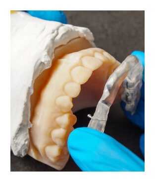Dentist using smile model to mold occlusal splint