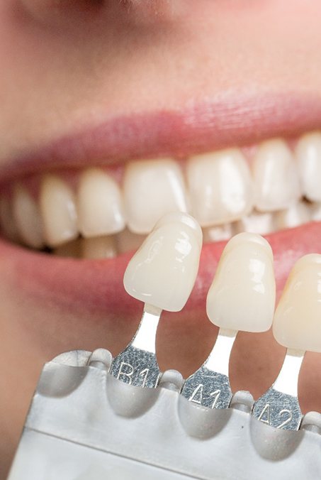 a shade chart being held up to a patient’s teeth