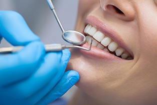 Dentist using dental tools to look at patient's smile