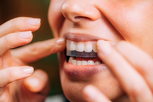 Matching patient's teeth to different shades of enamel